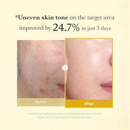 Kojic Acid Turmeric Overnight Mask